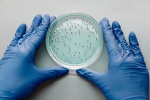 Pseudomonas aeruginosa em produtos Ypê