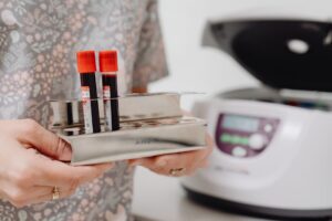 deficiência de vitamina B12 e seus sinais