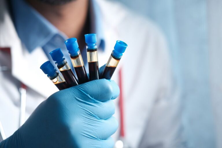 Exame de sangue câncer pulmão